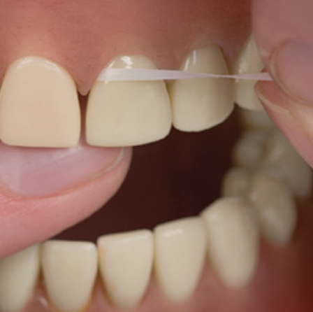 آموزش طرز صحیح استفاده از نخ دندان توسط دکتر زهرا ظهری متخصص جراحی لثه و ایمپلنت و لیزر در استان گیلان و شهر رشت